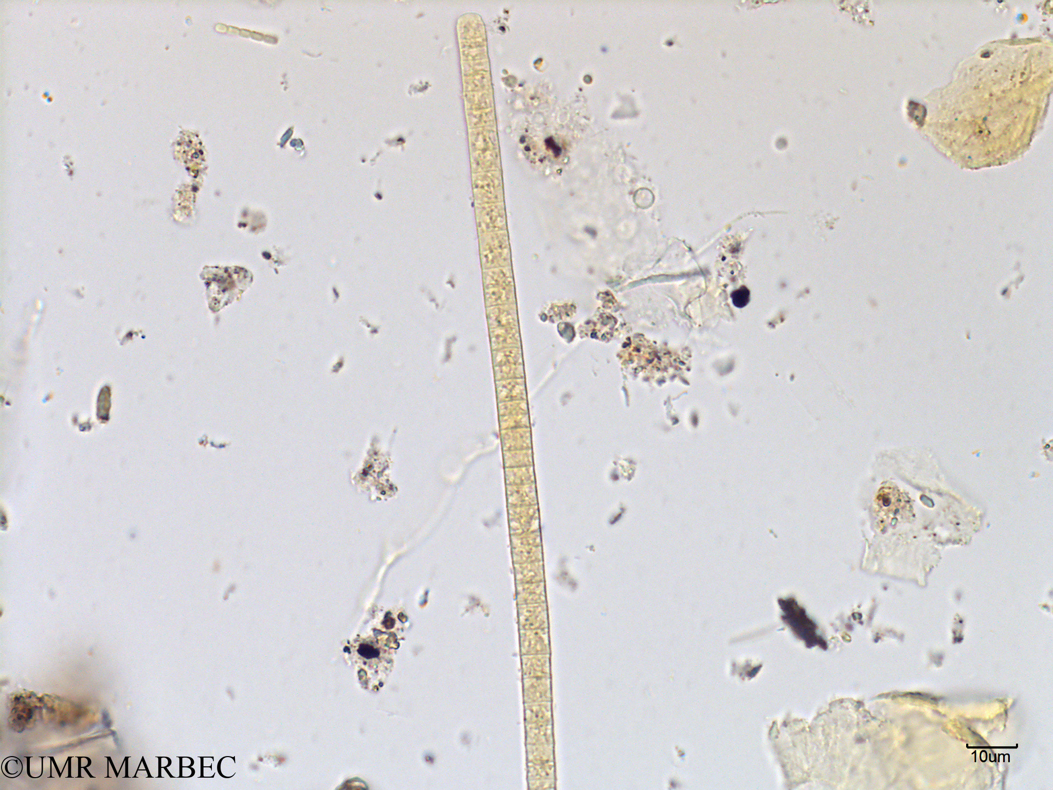 phyto/Scattered_Islands/mayotte_lagoon/SIREME May 2016/Trichodesmium sp4 (MAY2_trichodesmium-4).tif(copy).jpg